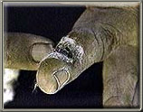 Image of injured finger