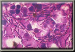 Graphic of 'purple strain' of anthrax bacillus